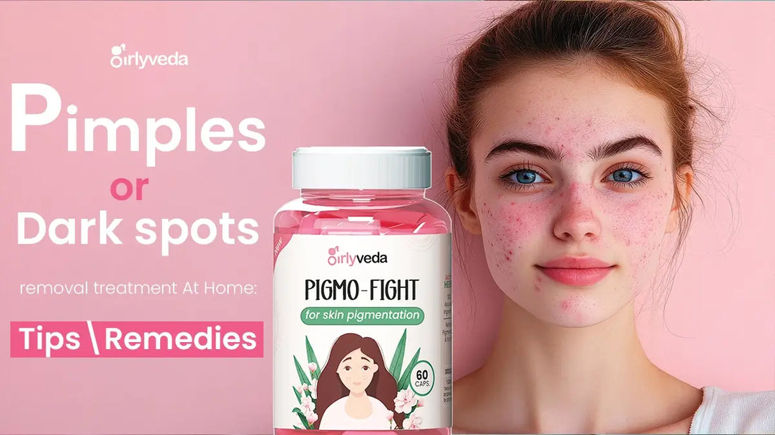 Pimples and dark spots removal treatment At Home: Tips and Remedies